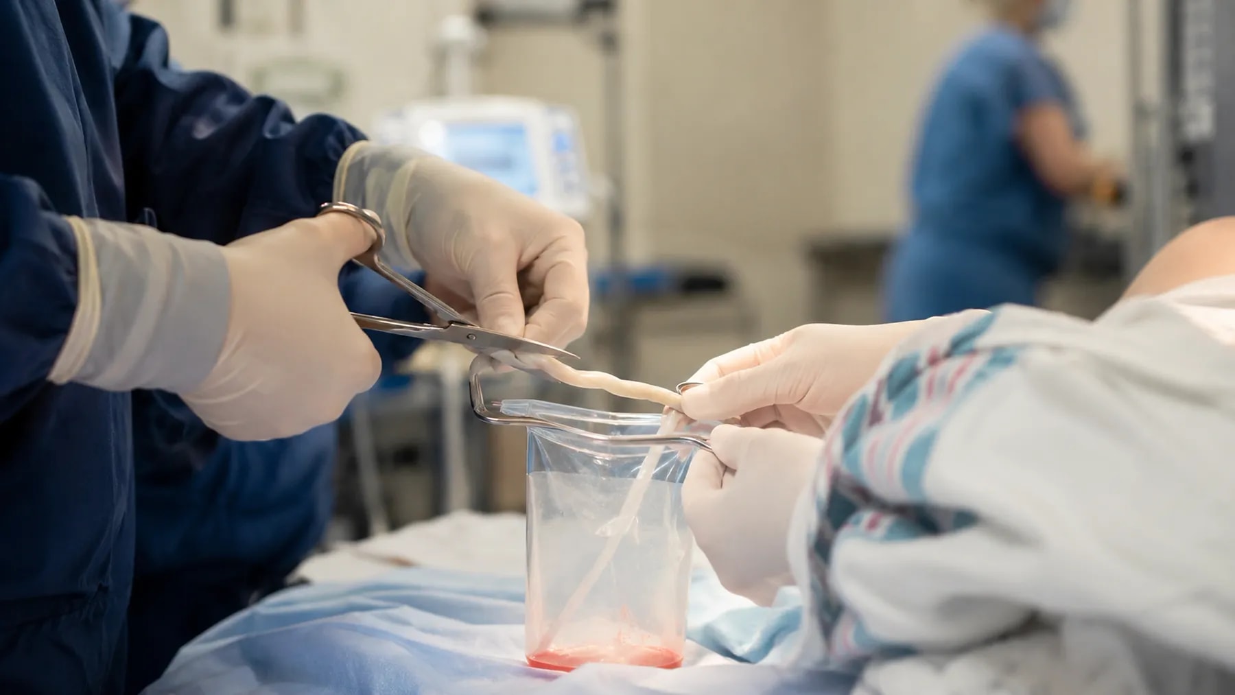 Umbilical cord tissue collected at the source